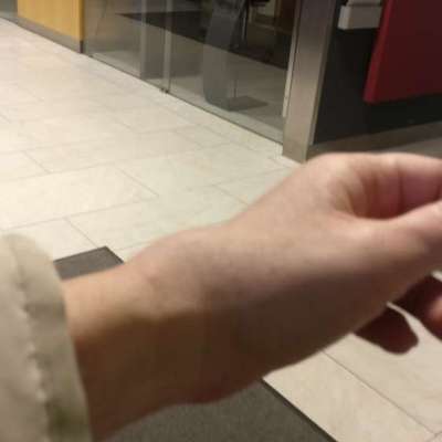 Welche Verletzungen habt ihr durch euren Hund erlitten?-Beitrag-Bild