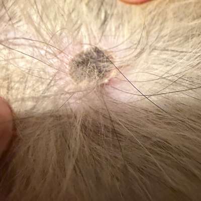 Hautveränderung entdeckt-Beitrag-Bild