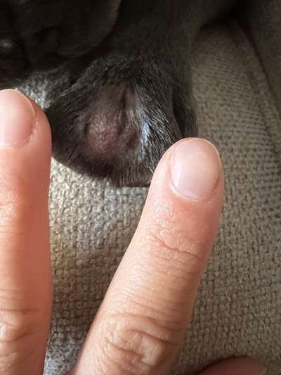 Blase zwischen den Zehen-Beitrag-Bild