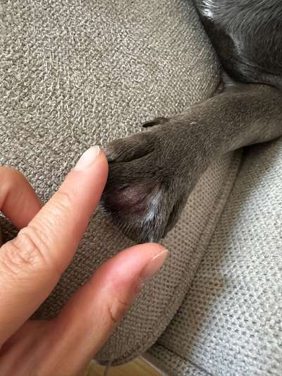 Blase zwischen den Zehen-Beitrag-Bild