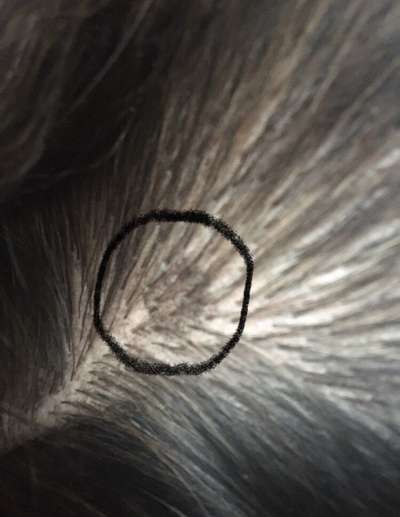 Hautkrebs oder Muttermal?-Beitrag-Bild