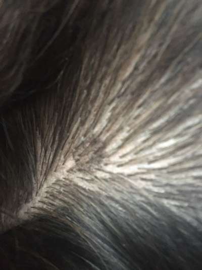 Hautkrebs oder Muttermal?-Beitrag-Bild