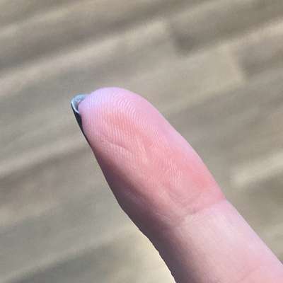 Welche Verletzungen habt ihr durch euren Hund erlitten?-Beitrag-Bild