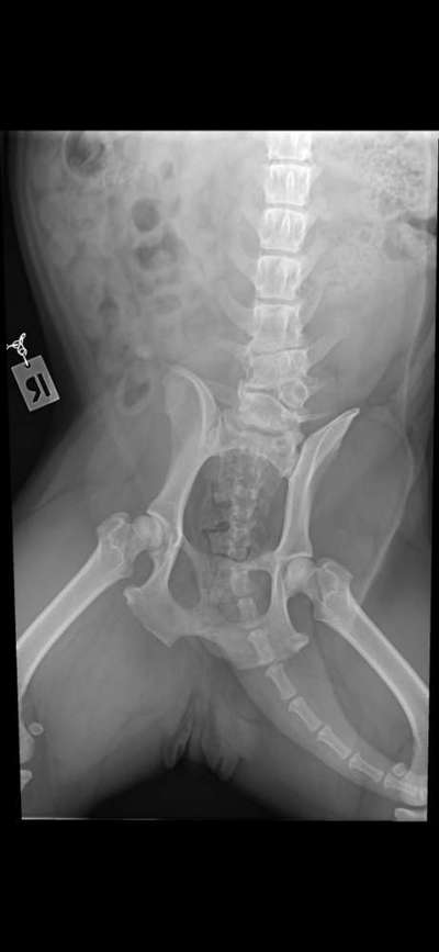 Gangbild/-analyse-Beitrag-Bild
