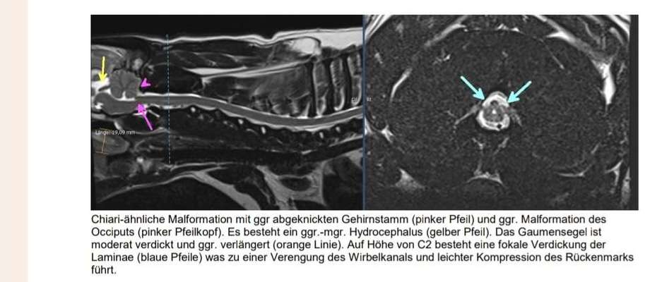Gangbild/-analyse-Beitrag-Bild