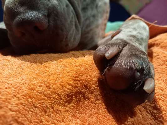 Halb abgerissene,gespaltene Daumenkralle-Beitrag-Bild