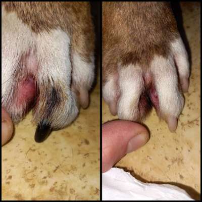 Entzündung/Abzess zwischen den Zehen-Beitrag-Bild