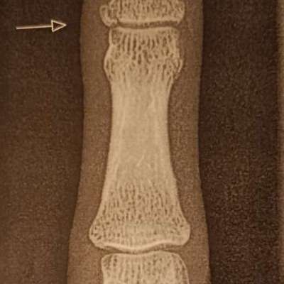 Was hat euch heute genervt?-Beitrag-Bild