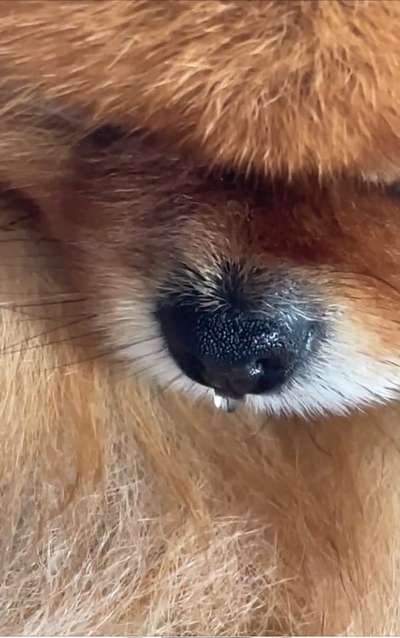 Nasenscheidewandverkrümmung-Beitrag-Bild