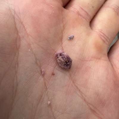 Giftköder-Potentiell Giftköder-Bild