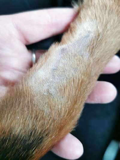 Neuroendokriner Tumor/ Dendtritische zelltherapie / Bestrahlung-Beitrag-Bild