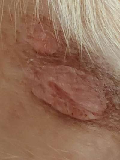 Hautausschlag Ekzem ?-Beitrag-Bild