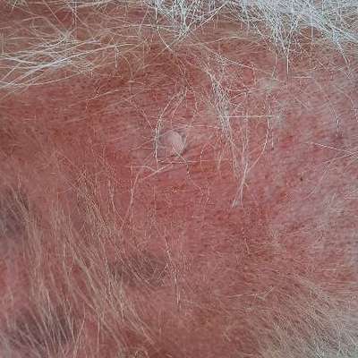 Jucken am Unterbauch-Beitrag-Bild