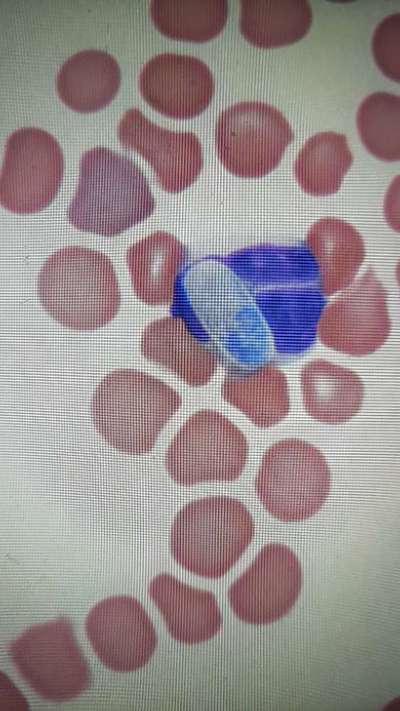 Hepatozoonose-Beitrag-Bild