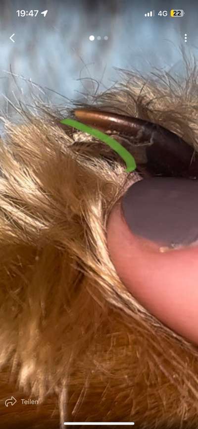 Gebrochene/brüchige Daumenkralle-Beitrag-Bild