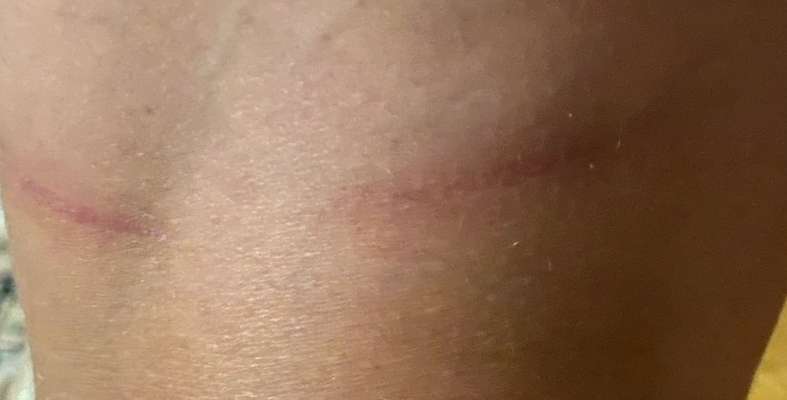 Flexileine-Beitrag-Bild