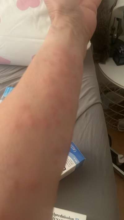 ⚠️🐛 Eichenprozessionsspinner – echte Gefahr für Hunde oder unnötige Panikmache?-Beitrag-Bild