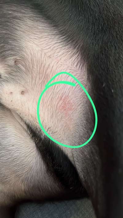 Ausschlag am Bauch-Beitrag-Bild