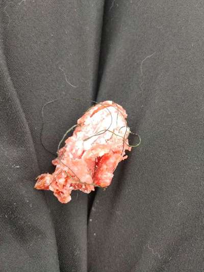 Giftköder-Salami mit Garn-Bild