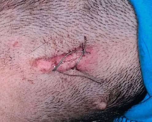 -BEANTWORTET-  Wundverheilung nach Kastration-Beitrag-Bild