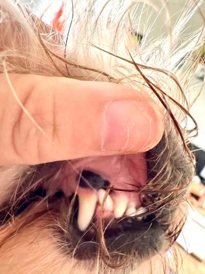 Zahnstein trotz putzen?-Beitrag-Bild