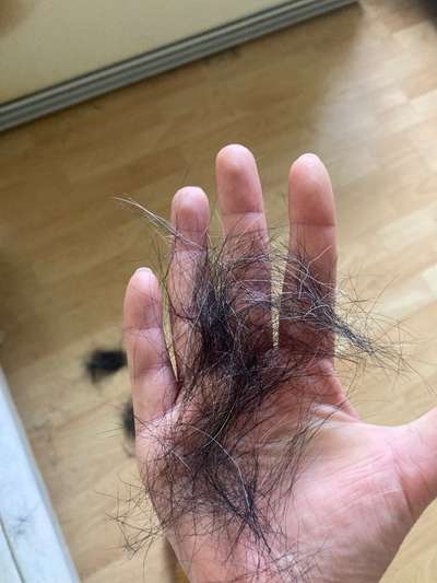 extremer Haarausfall-Beitrag-Bild