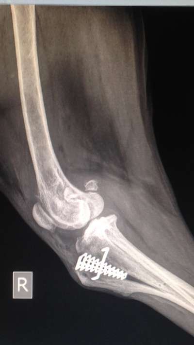 Konservative Behandlung bei Kreuzbandriss-Beitrag-Bild