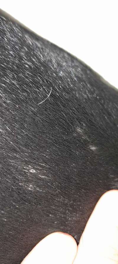 Pickel am ganzen Körper-Beitrag-Bild