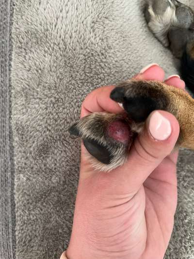 Entzündung/Abzess zwischen den Zehen-Beitrag-Bild