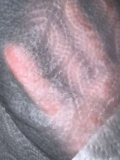 Kleine dunkle Krümelchen ums Ohr-Beitrag-Bild