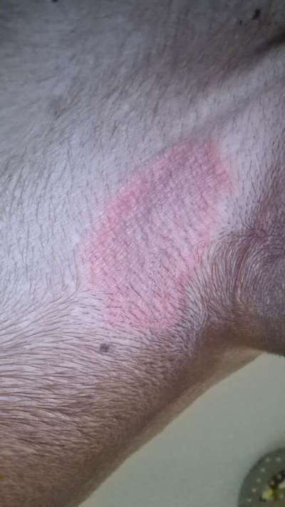 Rhodesian Ridgeback-Beitrag-Bild