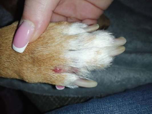 Entzündung/Abzess zwischen den Zehen-Beitrag-Bild