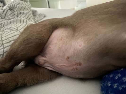 Ausschlag am Bauch-Beitrag-Bild