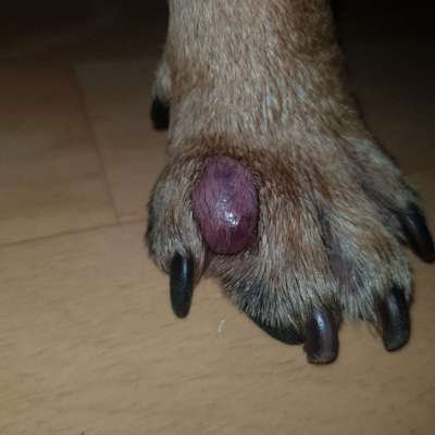 Entzündung/Abzess zwischen den Zehen-Beitrag-Bild