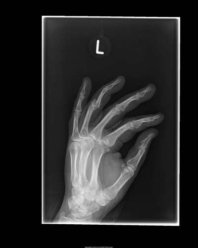 Rhodesian Ridgeback-Beitrag-Bild