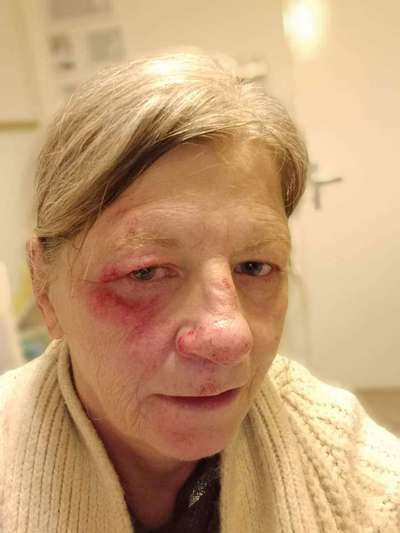 Panik beim Gassi gehen-Beitrag-Bild