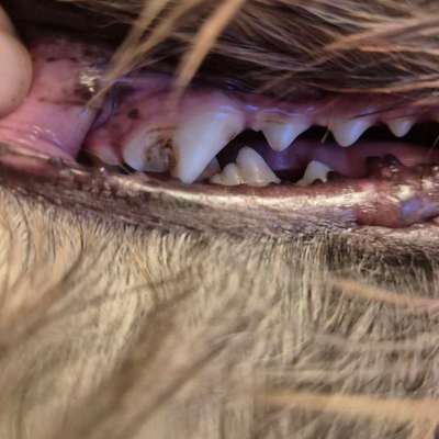 Zahnstein-Beitrag-Bild