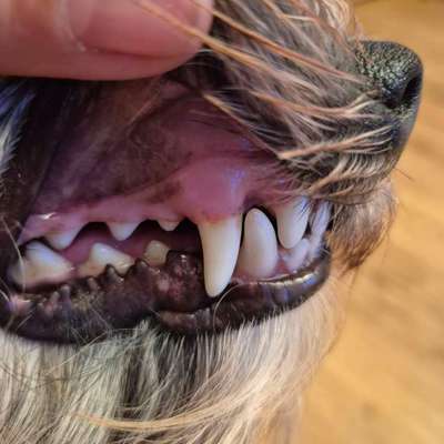 Zahnstein-Beitrag-Bild