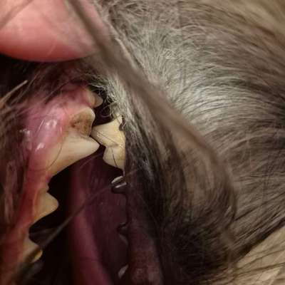 Zahnstein-Beitrag-Bild