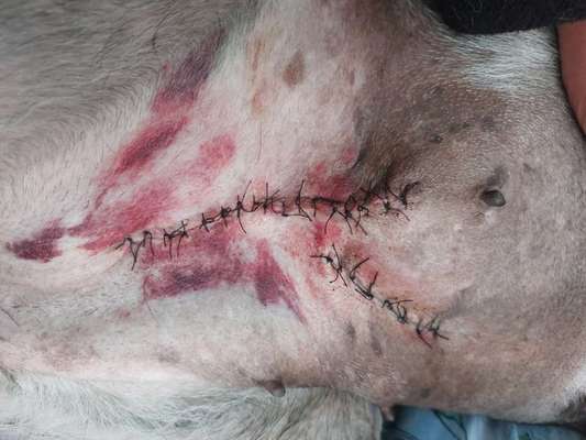 OP Naht Hämatome-Beitrag-Bild