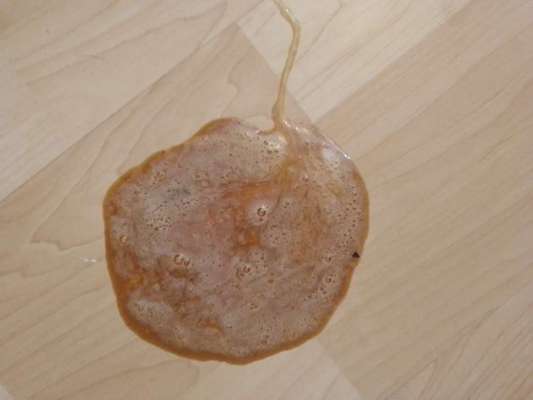 durchfall mit erbrechen-Beitrag-Bild