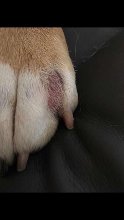 Komische stelle zwischen den Zehen-Beitrag-Bild