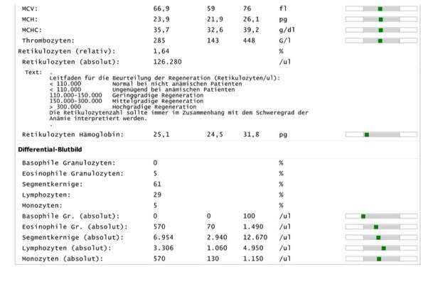 Spooky Phase mit 4 Jahren?-Beitrag-Bild
