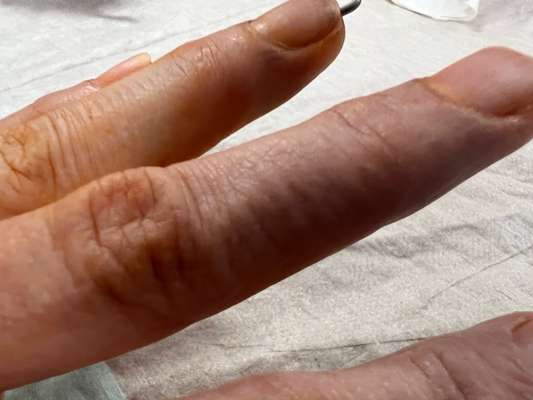 Rhodesian Ridgeback-Beitrag-Bild