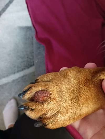 Entzündung/Abzess zwischen den Zehen-Beitrag-Bild