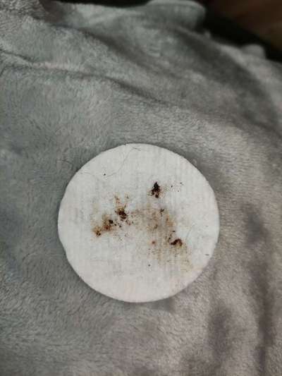 Ohr riecht "käsig"-Beitrag-Bild