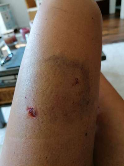 Hundeangriff in Griechenland - wie verhindern, vorbeugen?-Beitrag-Bild