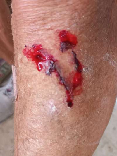 Geschirr oder Halsband ?-Beitrag-Bild