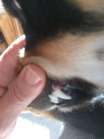 Zahnstein entfernen-Beitrag-Bild