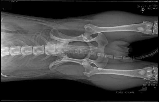 Gangbild/-analyse-Beitrag-Bild